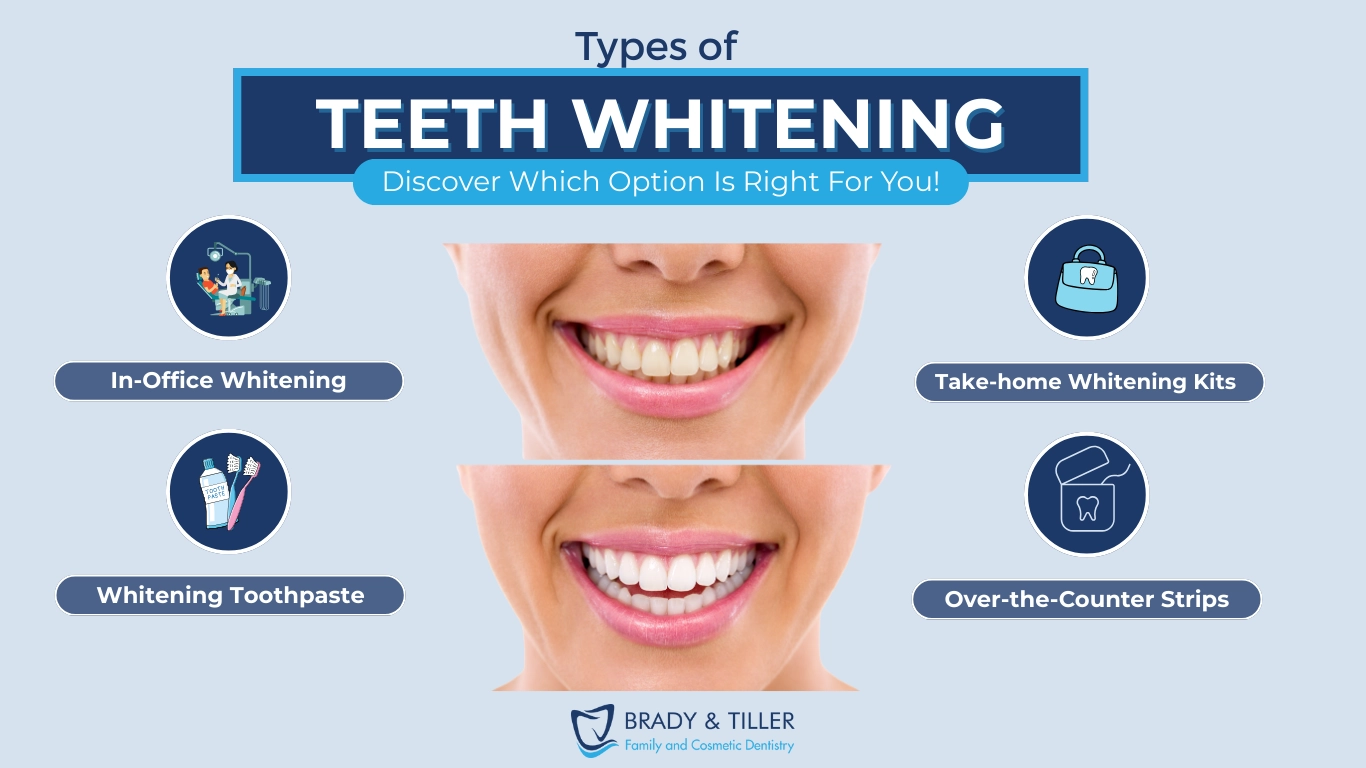 Brady-Types of teeth